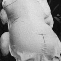 http://www.oandplibrary.org/cpo/images/1985_04_035/1985_04_035-06.jpg
