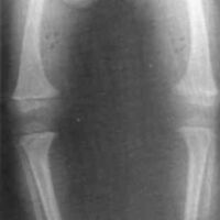 http://www.oandplibrary.org/cpo/images/1985_02_003/1985_02_003-05.jpg