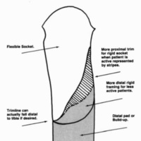 http://www.oandplibrary.org/cpo/images/1986_02_093/1986_02_093-5.jpg