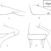 http://www.oandplibrary.org/al/images/1961_01_004/a002.jpg