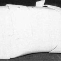 http://www.oandplibrary.org/cpo/images/1988_02_067/1988_02_067-05.jpg