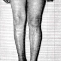 http://www.oandplibrary.org/al/images/1967_01_001/1967_01_001-02.jpg