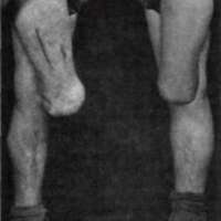 http://www.oandplibrary.org/al/images/1970_01_001/1970_01_001-12.jpg