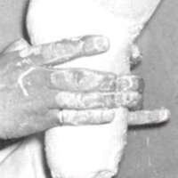 http://www.oandplibrary.org/al/images/1965_01_004/tmp1F18-5.jpg
