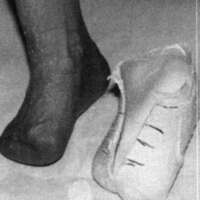 http://www.oandplibrary.org/cpo/images/1988_01_019/1988_01_019-02.jpg