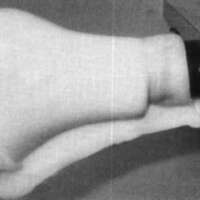 http://www.oandplibrary.org/cpo/images/1988_01_024/1988_01_024-3.jpg