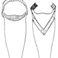 http://www.oandplibrary.org/al/images/1965_01_023/spring65-1.jpg
