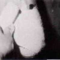 http://www.oandplibrary.org/al/images/1971_01_001/1971_01_001-25.jpg