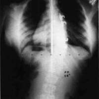http://www.oandplibrary.org/cpo/images/1985_04_035/1985_04_035-04.jpg