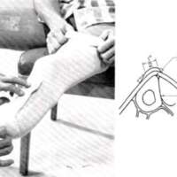 http://www.oandplibrary.org/al/images/1966_02_005/aut66-2-04.jpg