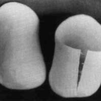 http://www.oandplibrary.org/cpo/images/1987_01_033/1987_01_033-06.jpg