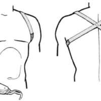http://www.oandplibrary.org/al/images/1954_03_047/tmp3B8-16.jpg