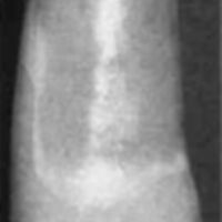 http://www.oandplibrary.org/cpo/images/1985_04_031/1985_04_031-05.jpg