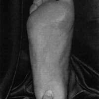 http://www.oandplibrary.org/cpo/images/1988_02_044/1988_02_044-1.jpg