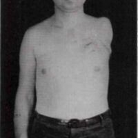 http://www.oandplibrary.org/al/images/1963_02_001/1963-Autumn-17.jpg
