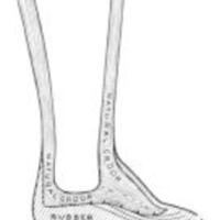 http://www.oandplibrary.org/al/images/1961_01_052/c004.jpg