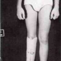http://www.oandplibrary.org/al/images/1971_01_022/1971_01_022-01.jpg