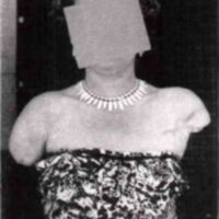 http://www.oandplibrary.org/al/images/1957_01_004/1957-Spring-19.jpg