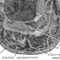 http://www.oandplibrary.org/al/images/1961_01_004/a019.jpg