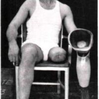 http://www.oandplibrary.org/al/images/1957_01_041/1957-Spring-51.jpg