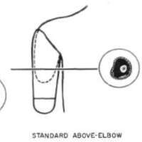 http://www.oandplibrary.org/al/images/1955_03_004/tmp482-19.jpg